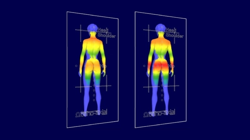gesund liegen dank minimaler Druckbelastung ERGOFITair