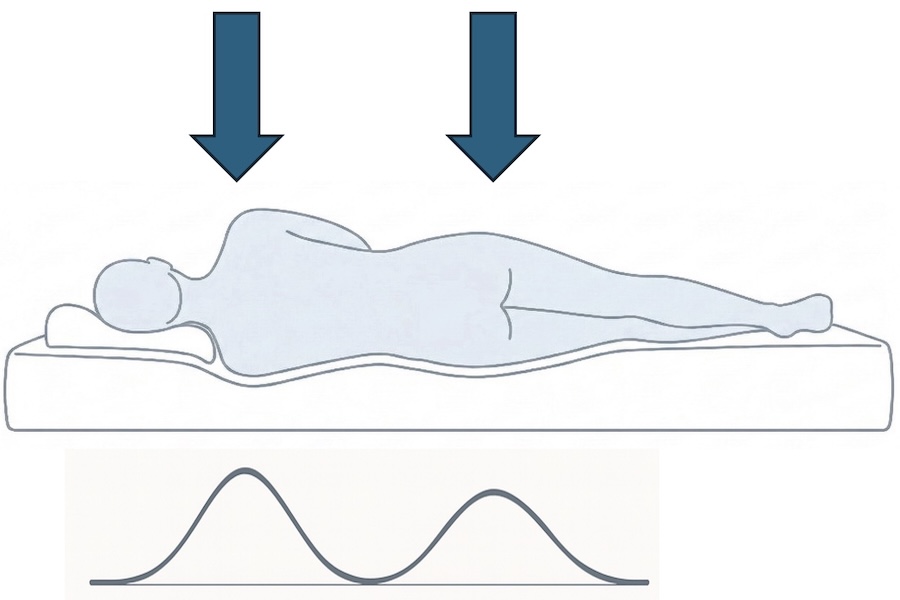 Grafisches Grundmodell zur Darstellung der Druckverteilung von Schulter und Hüfte beim Liegen