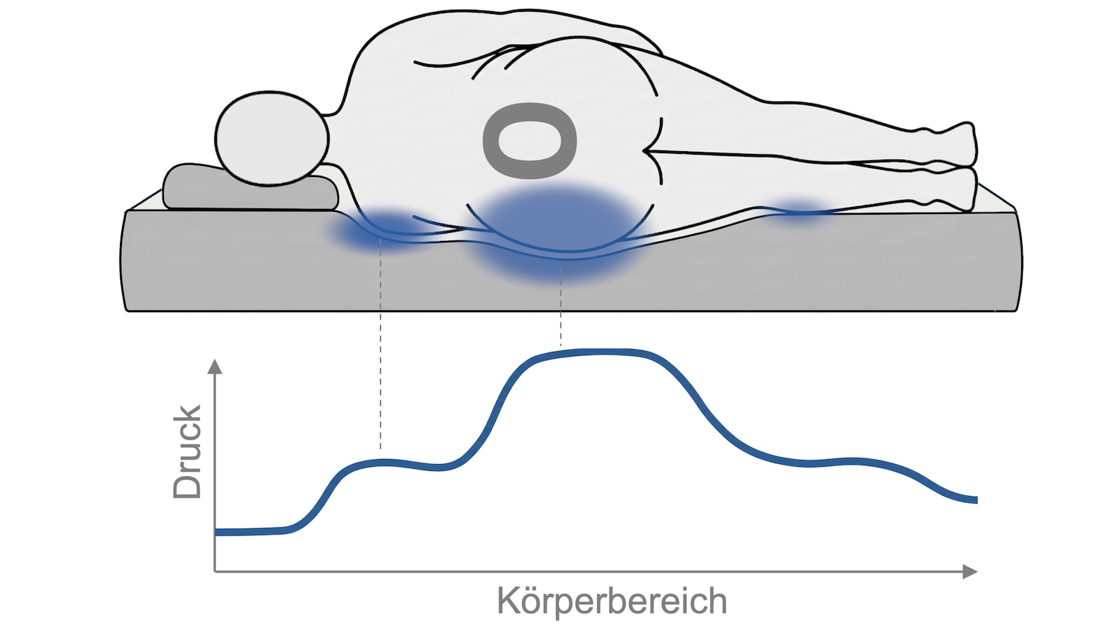 Körperform O mit erhöhter Druckbelastung in der Körpermitte in der Liegesituation