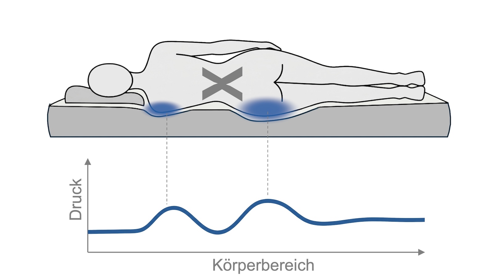 Körperform X mit differenzierter Druckverteilung zwischen Schulter und Becken im Liegen
